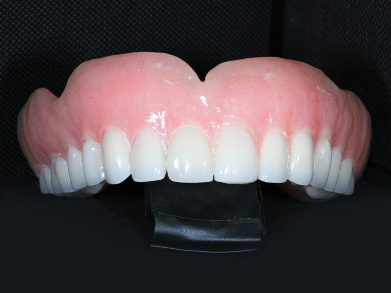 PostOp Instructions Barry Road Dental Group