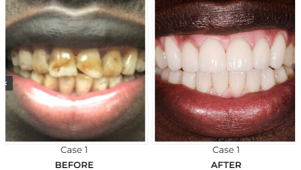 Northland Kansas City Dentist 
