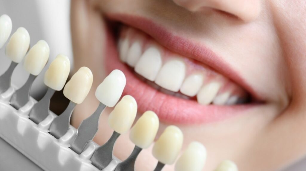 Cosmetic Dentist in Parkville